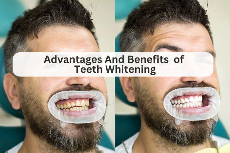 teeth whitening at dental lounge bahria town lahore